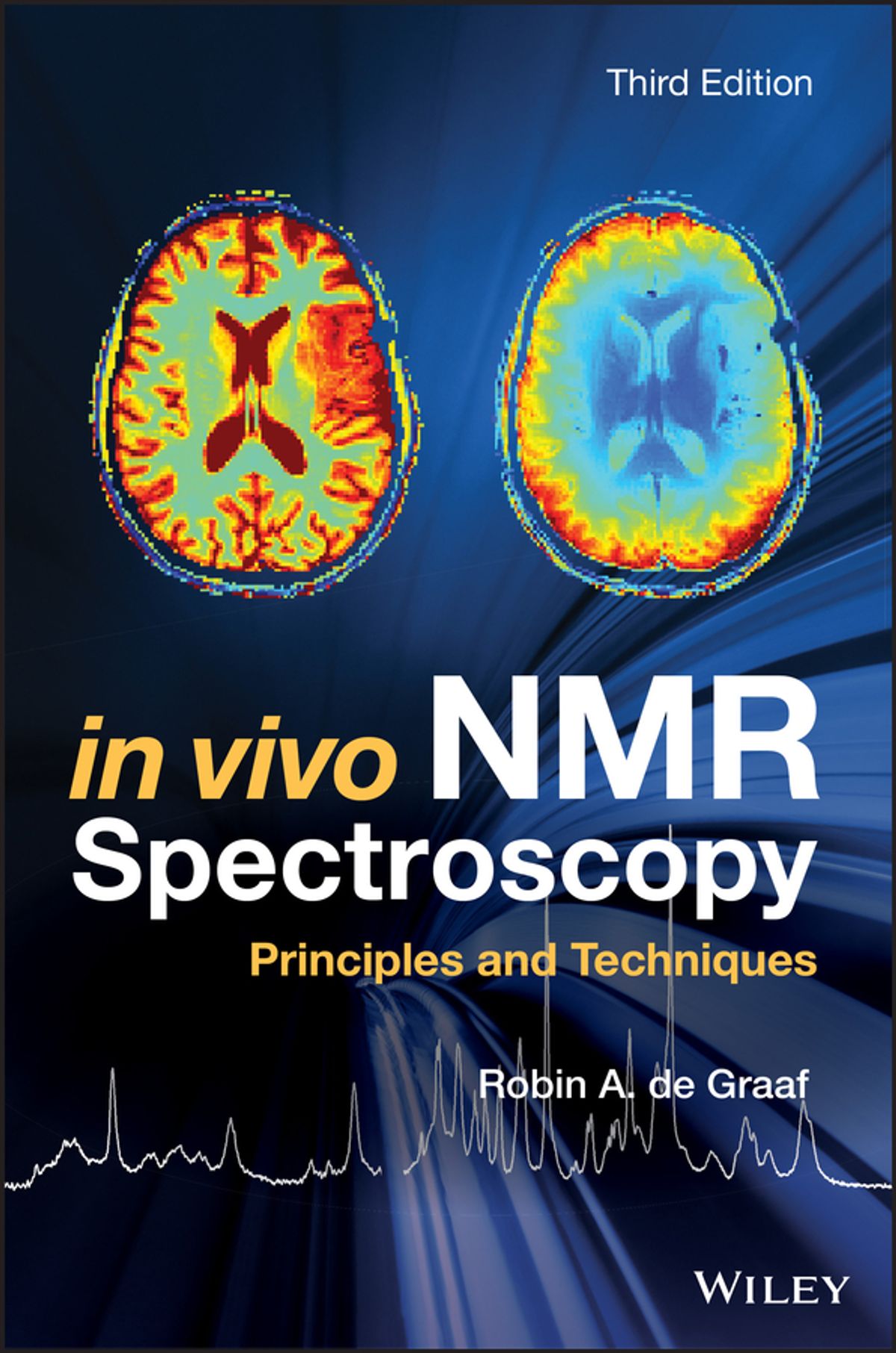 In vivo NMR spectroscopy: principles and techniques
